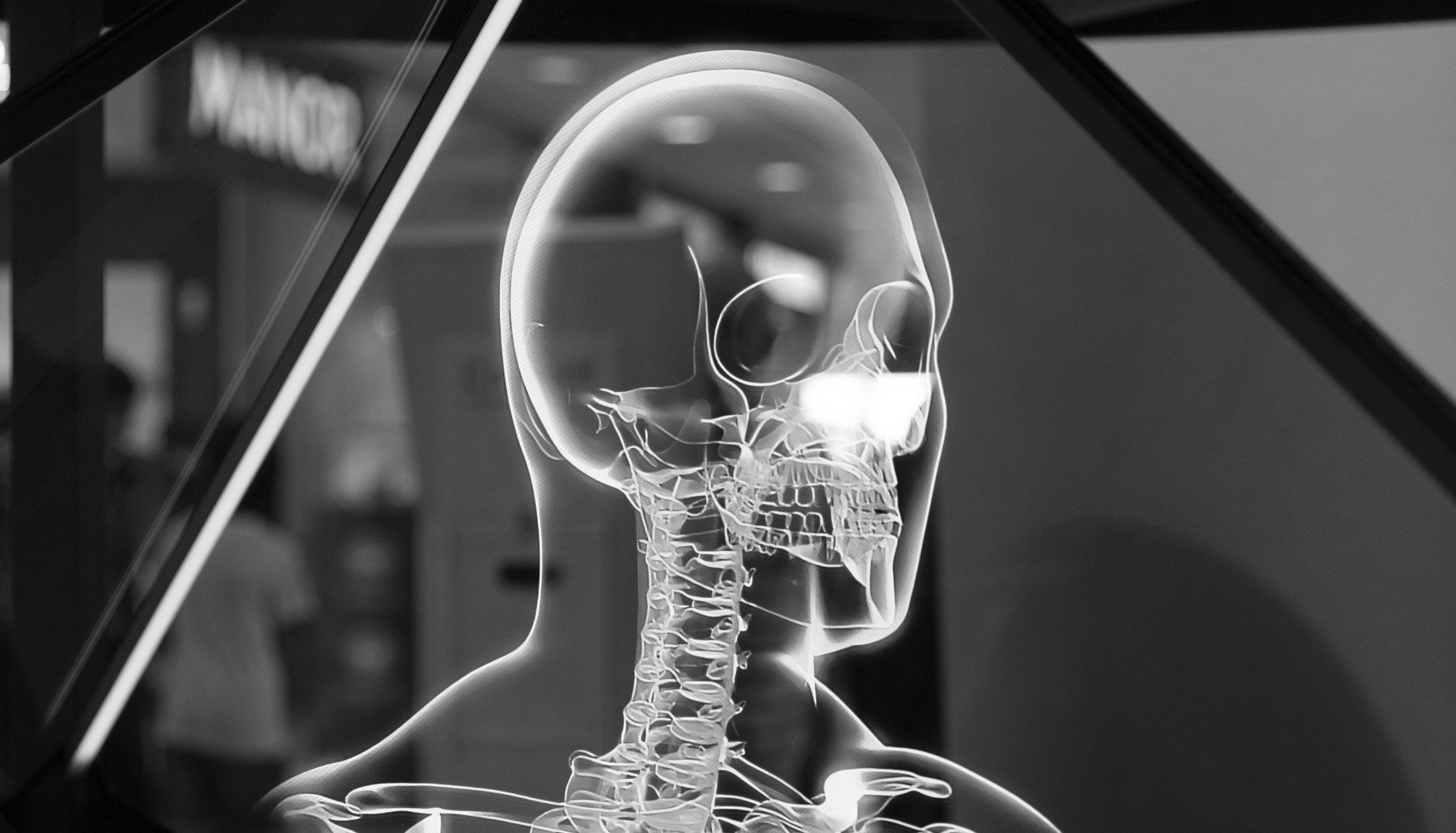 Medical holography is the future and Realfiction displays can benefit as a multiuser display